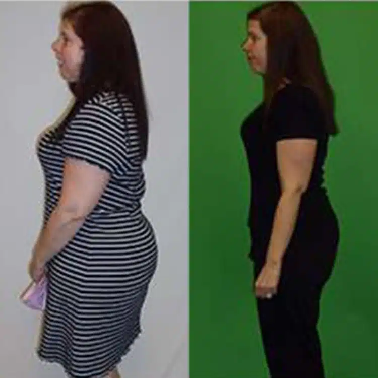 nicole w weight loss before and after scottsdale weight loss center